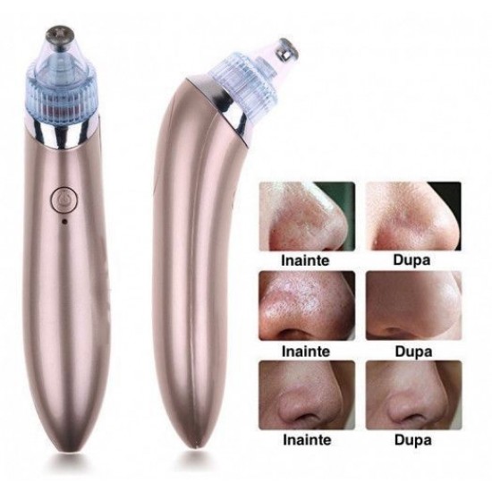 Aspirator Facial D.S. INGRIJIRE PERSONALA
